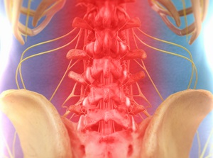 Spinal Decompression Therapy for pain relief Glendale