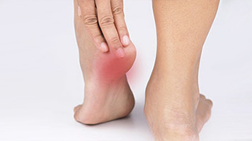 Plantar Fasciitis Treatment Glendale