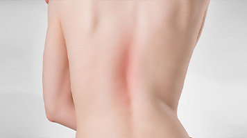 Scoliosis Treatment Glendale